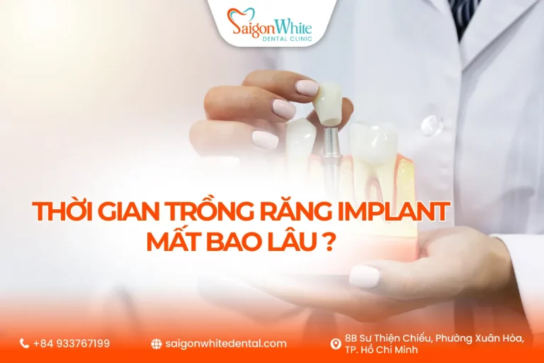 Thời gian trồng răng implant mất bao lâu?