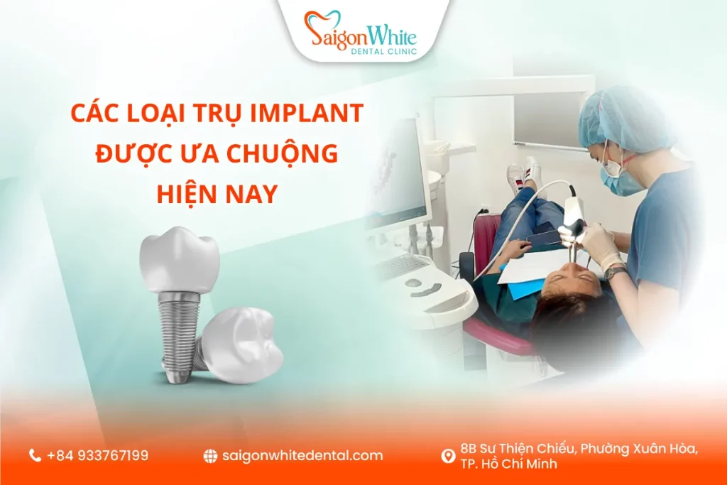 Các Loại Trụ Implant Được Ưa Chuộng Hiện Nay