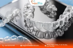 Điều kiện để Invisalign phát huy hiệu quả tối đa