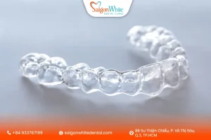 Niềng răng trong suốt Invisalign có thực sự hiệu quả ?