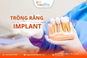 Review Trồng Răng Implant Tại Phòng Khám Nha Khoa Sài Gòn White