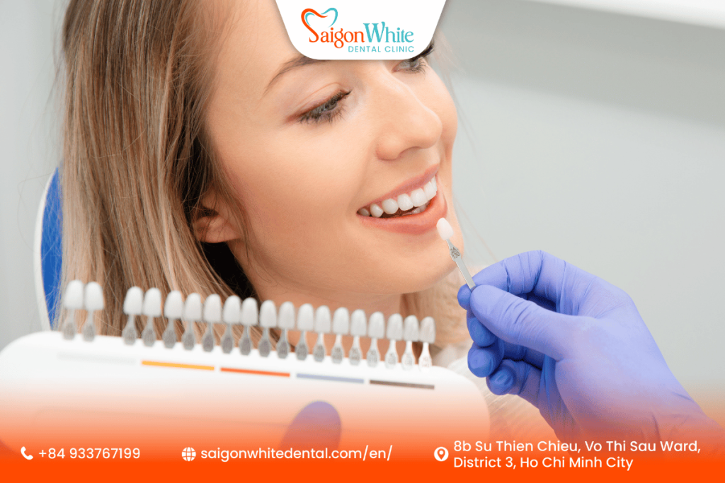 What Are Dental Veneers?