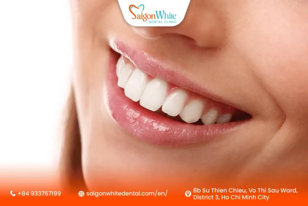 Teeth whitening