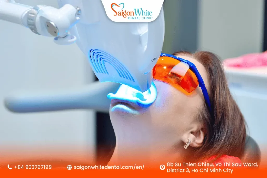 Why Get Teeth Whitening in Vietnam?