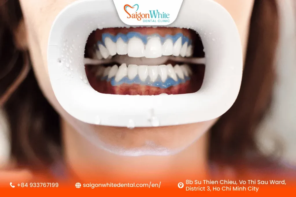 What Is Teeth Whitening?
