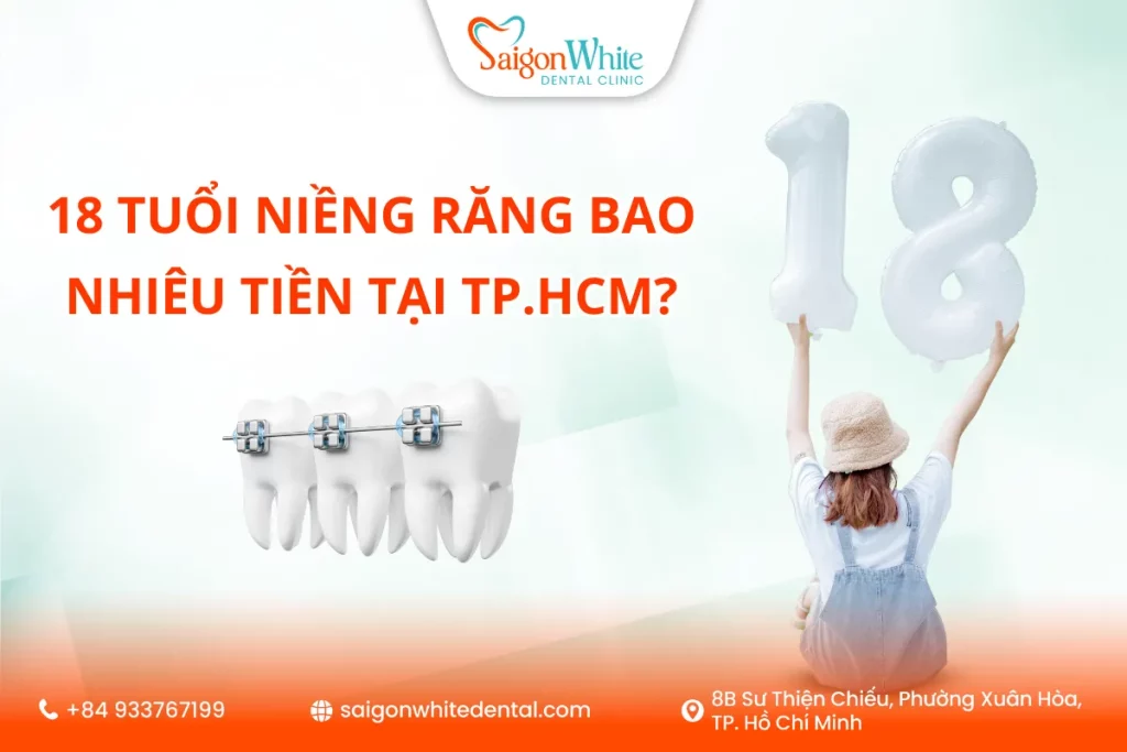 18 tuổi niềng răng bao nhiêu tiền tại TP.HCM?