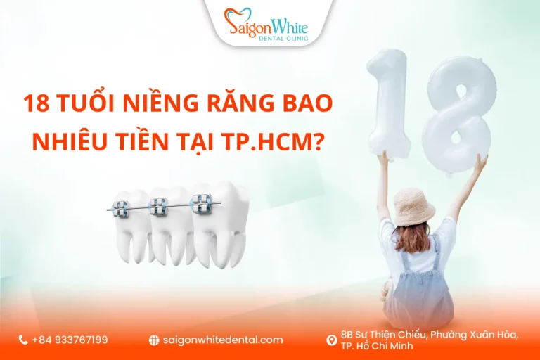 18 tuổi niềng răng bao nhiêu tiền tại TP.HCM?