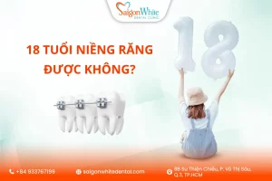 18 Tuổi niềng răng được không ?