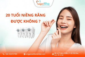 20 Tuổi niềng răng được không ?