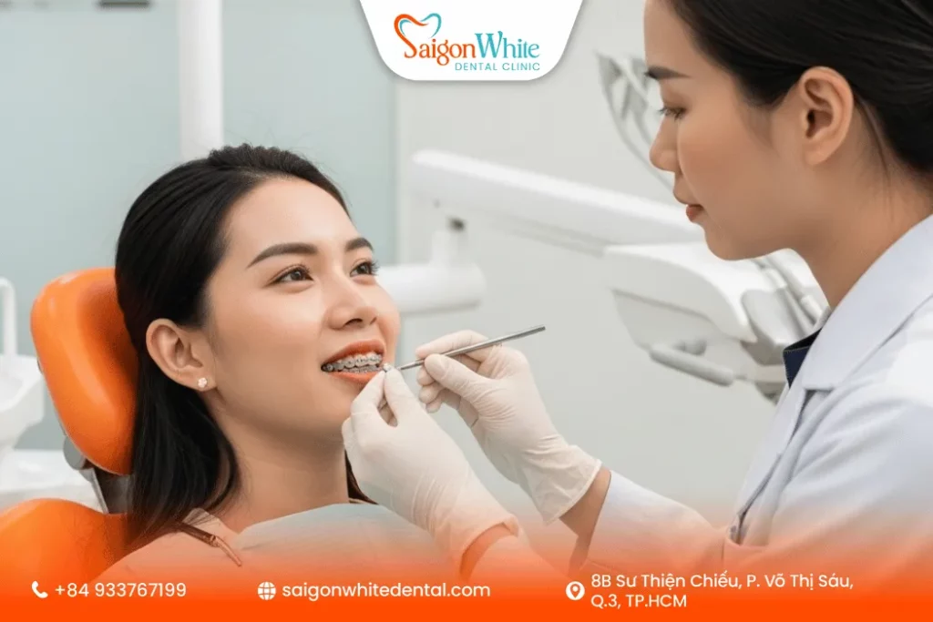 Những điều cần lưu ý khi niềng răng tuổi 30