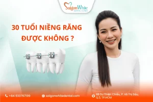 30 Tuổi niềng răng được không ?
