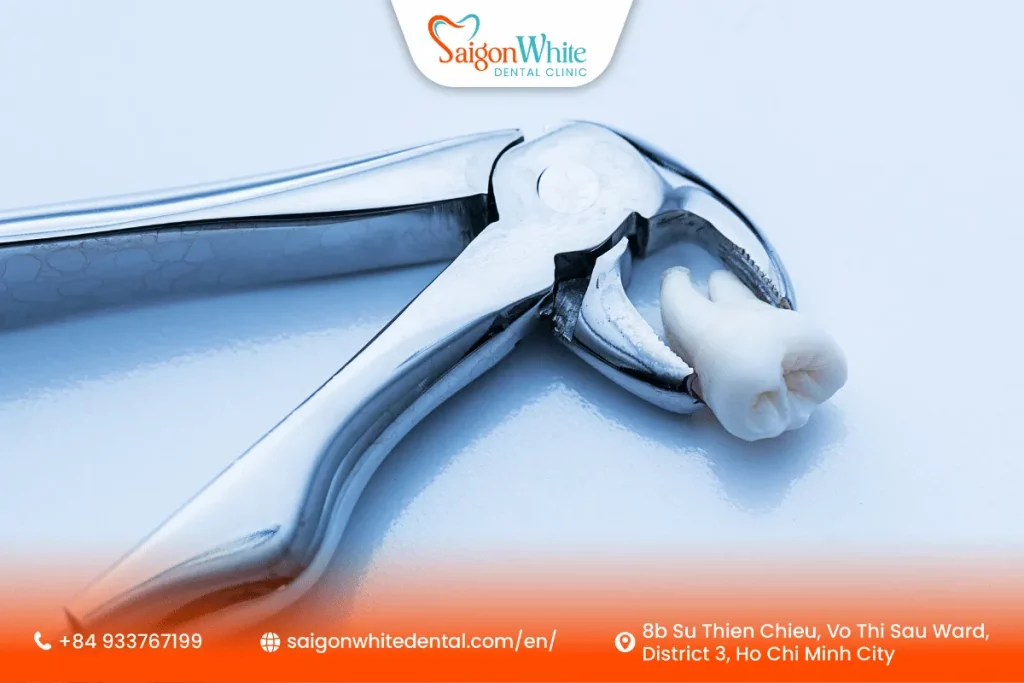 Dental care after wisdom tooth extraction