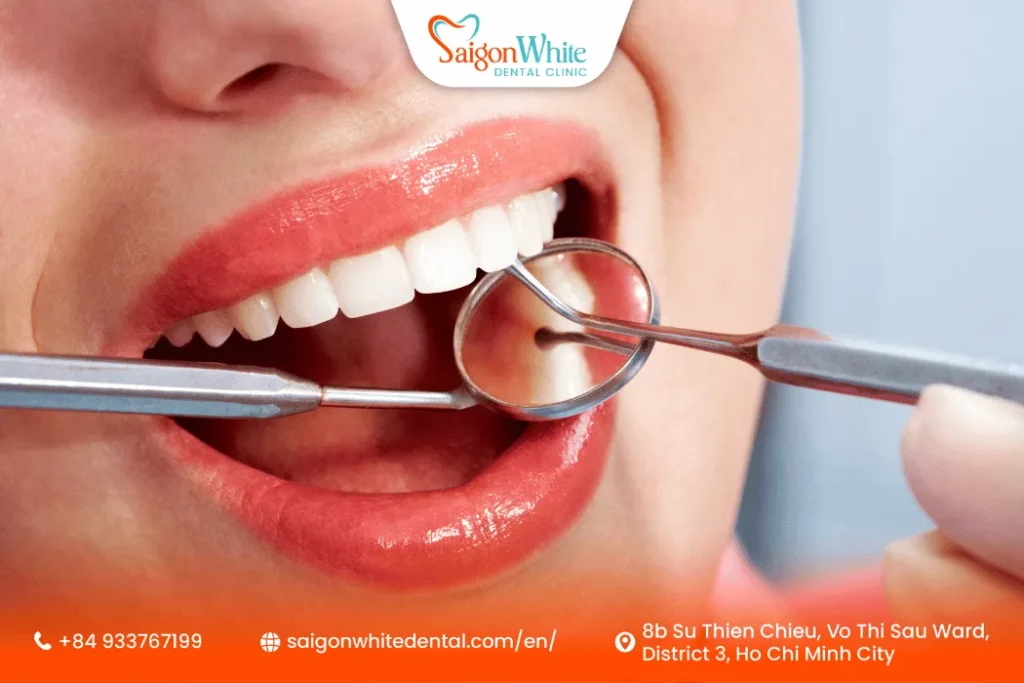 Dental service tooth fillings in Ho Chi Minh City Vietnam