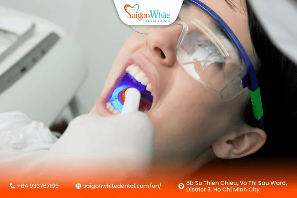 How much do tooth fillings cost at Saigon White Dental?