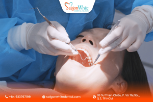 Nguyên nhân thất bại cấy Implant ở người trung niên