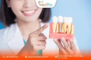Những rủi ro có thể gặp khi cấy Implant ở người có bệnh lý nền