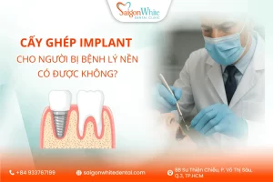 Cấy ghép răng Implant cho người bị bệnh lý nền có được không?