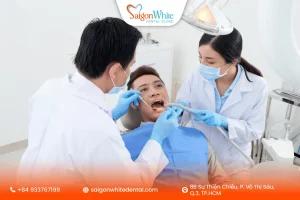 Cấy trụ implant bao lâu thì có thể gắn mão răng sứ?