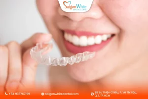 Niềng răng lần 2 có gì khác so với lần đầu?