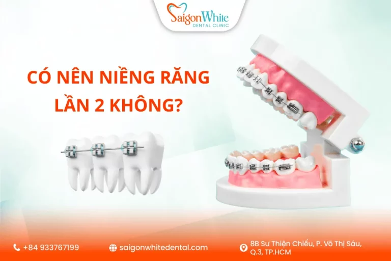 Có nên niềng răng lần 2 không?