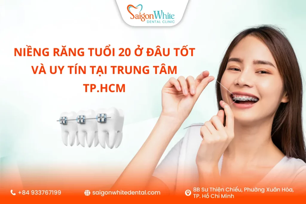 Niềng răng tuổi 20 ở đâu tốt và uy tín tại trung tâm TP.HCM?