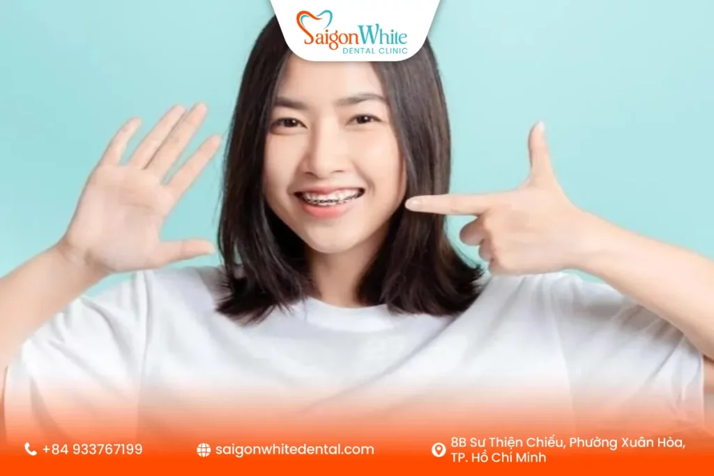 Các phương pháp niềng răng phù hợp cho người 20 tuổi