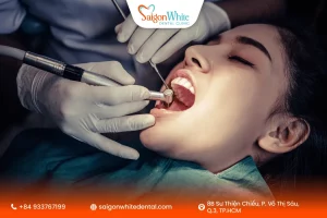 Cấy răng Implant khi xương yếu có khả thi không?