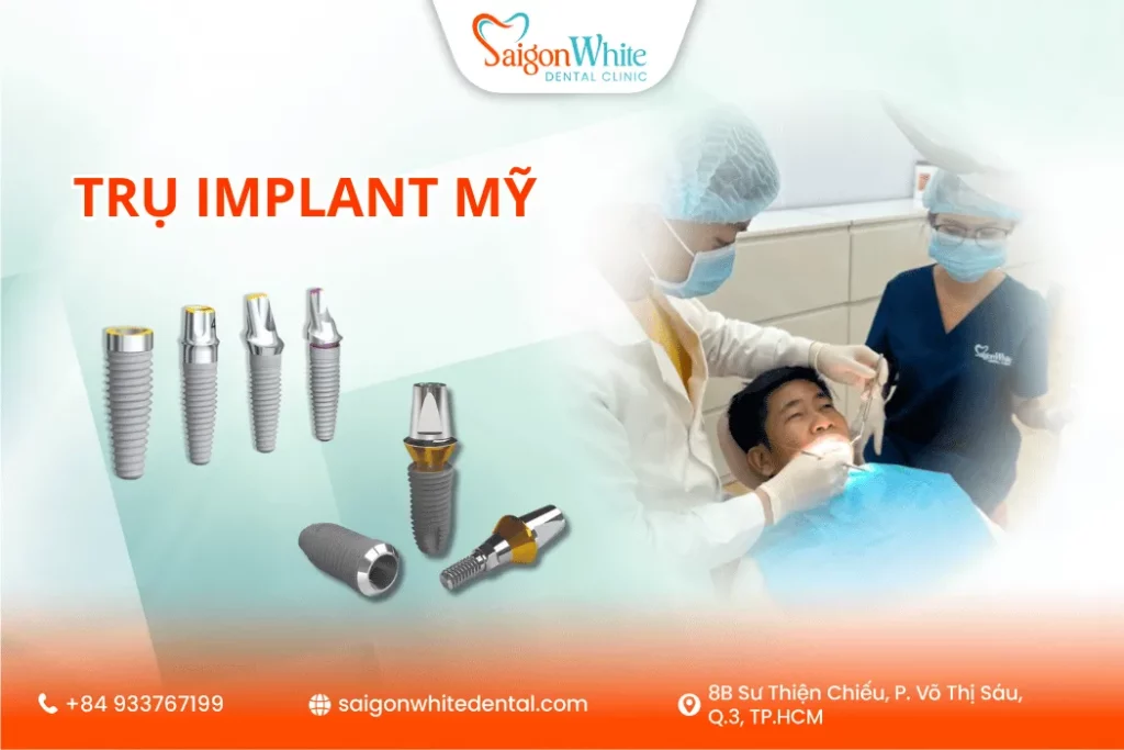 Trụ Implant Mỹ có giá cao không?