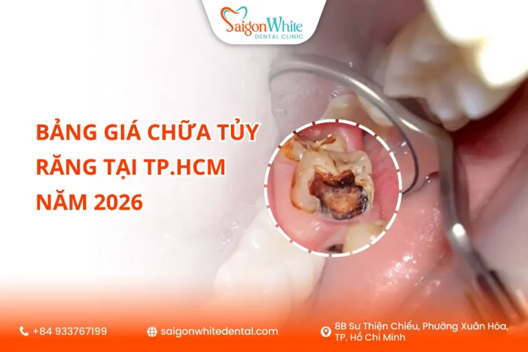 Bảng giá chữa tủy răng tại TP.HCM