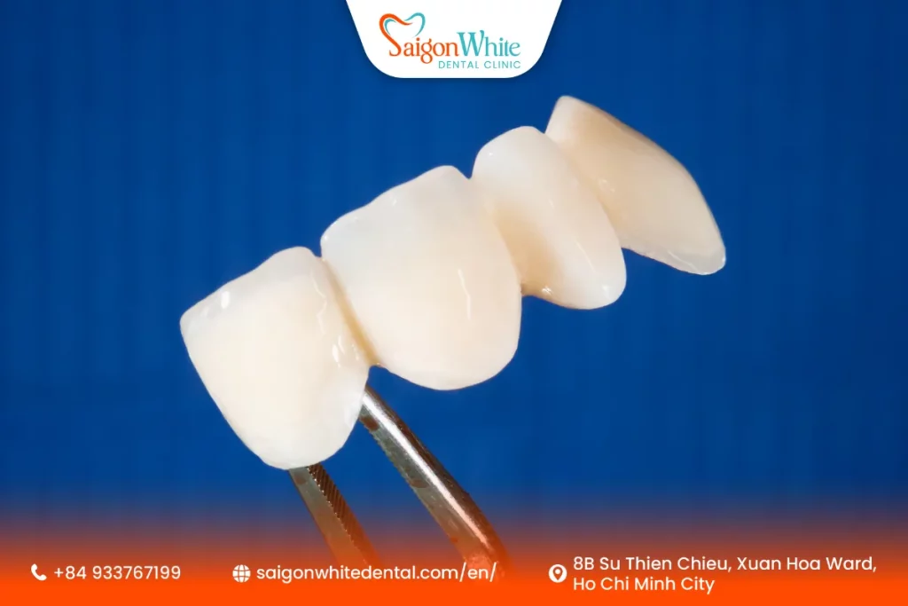 Dental Crowns