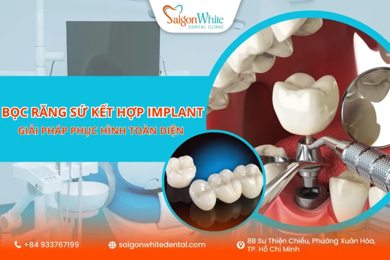 Bọc răng sứ kết hợp implant - Giải pháp phục hình toàn diện