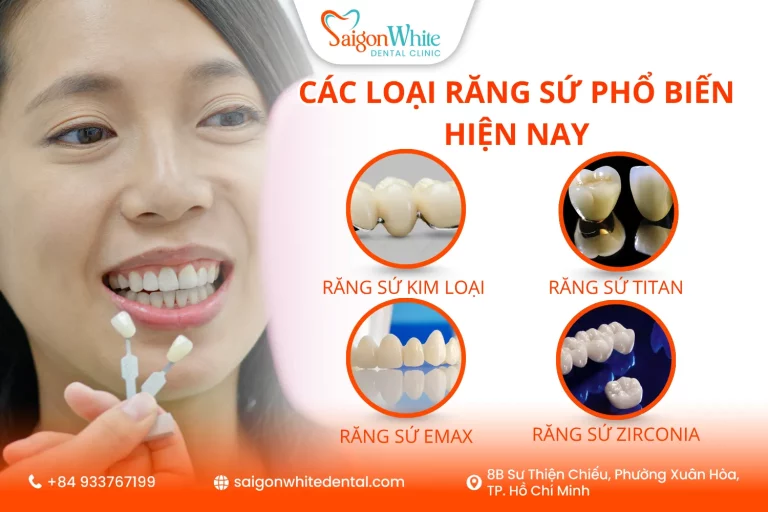 Các loại răng sứ phổ biến hiện nay. Nên chọn loại nào?