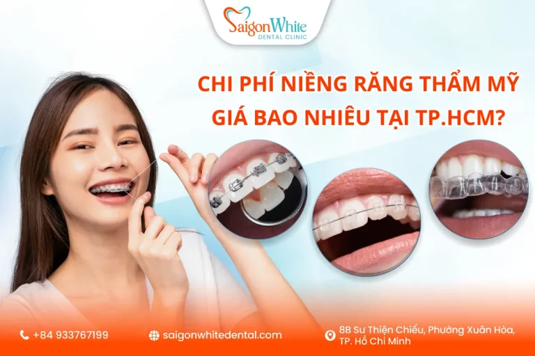 Chi phí niềng răng thẩm mỹ giá bao nhiêu tại TP.HCM?