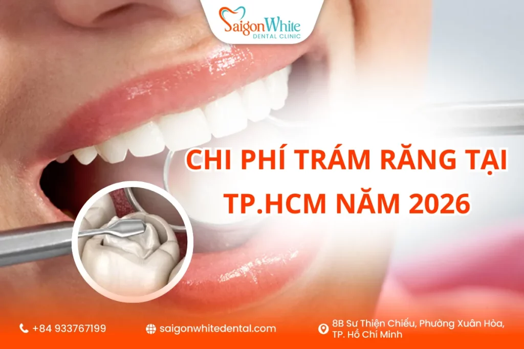 Chi phí trám răng tại TP HCM năm 2026