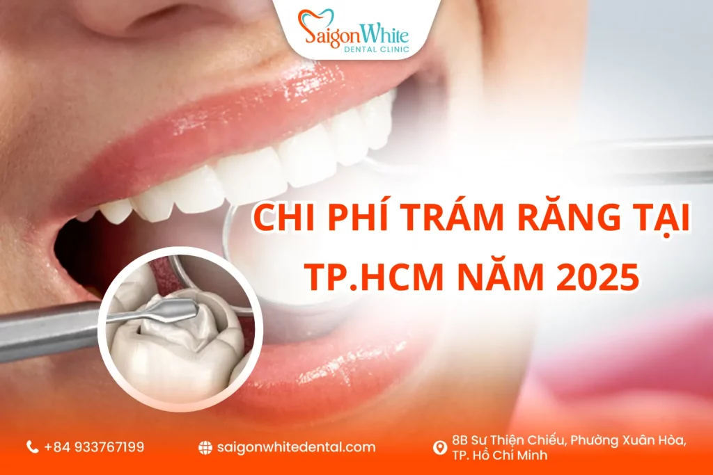 Chi phí trám răng tại TP.HCM năm 2025