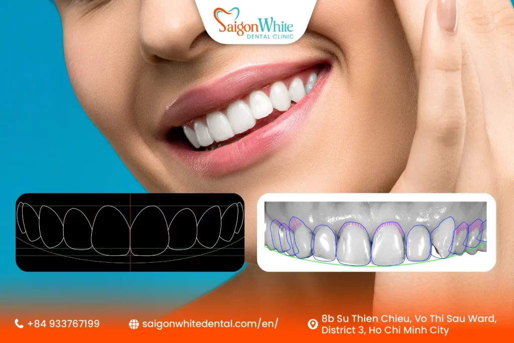 The technology used in the digital smile design service at Saigon White Dental