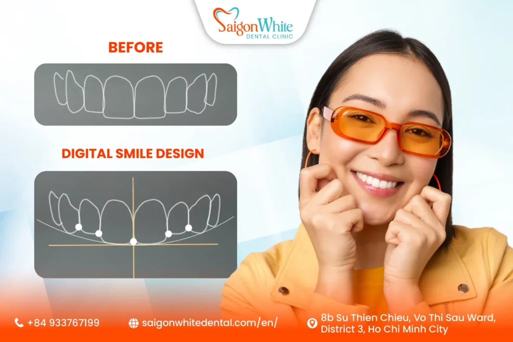 Digital Smile Design Service