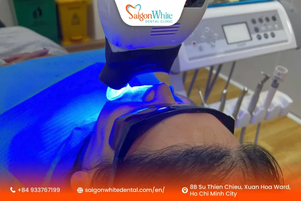 Does Teeth Whitening Damage Enamel?