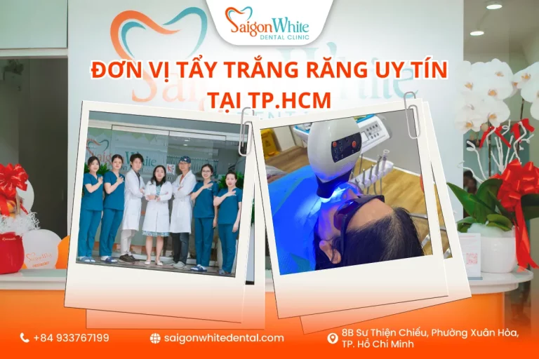 Đơn vị tẩy trắng răng uy tín tại TP.HCM
