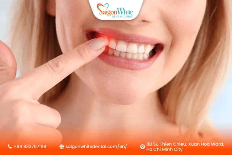 Periodontal disease causes gum swelling