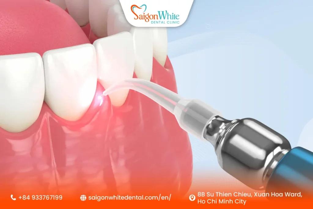What Is Periodontal Treatment?