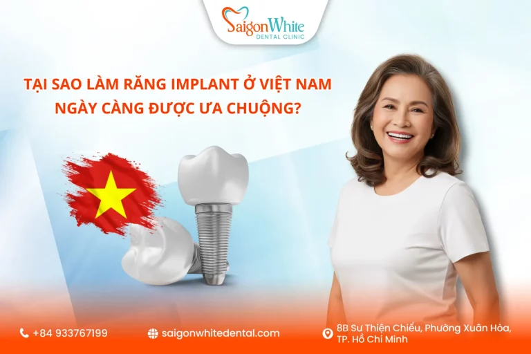 Lam rang implant o Viet Nam