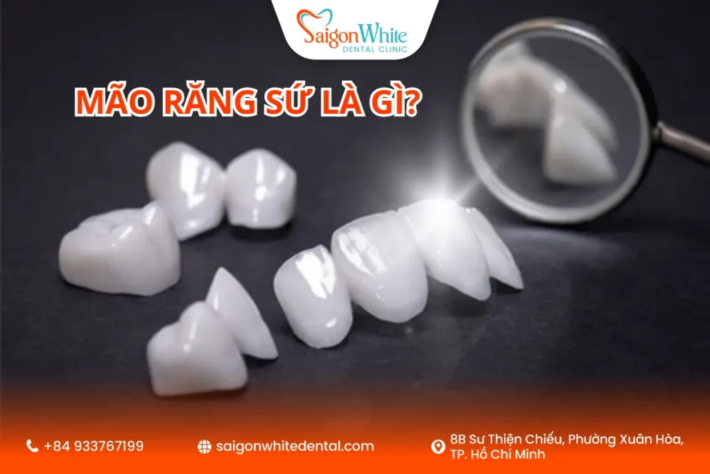 Mão răng sứ giải pháp phục hình răng tối ưu