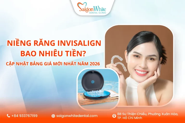 Niềng răng invisalign bao nhiêu tiền? Cập nhật bảng giá 2026