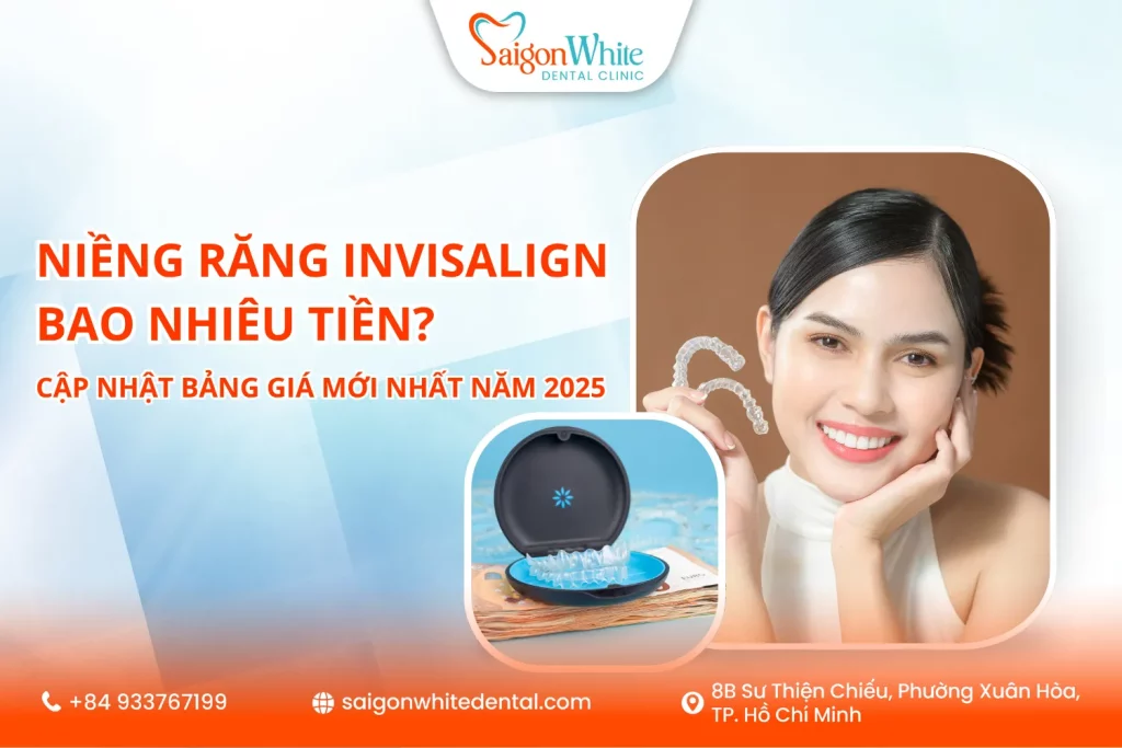 Niềng răng Invisalign bao nhiêu tiền? Cập nhật bảng giá mới nhất năm 2025