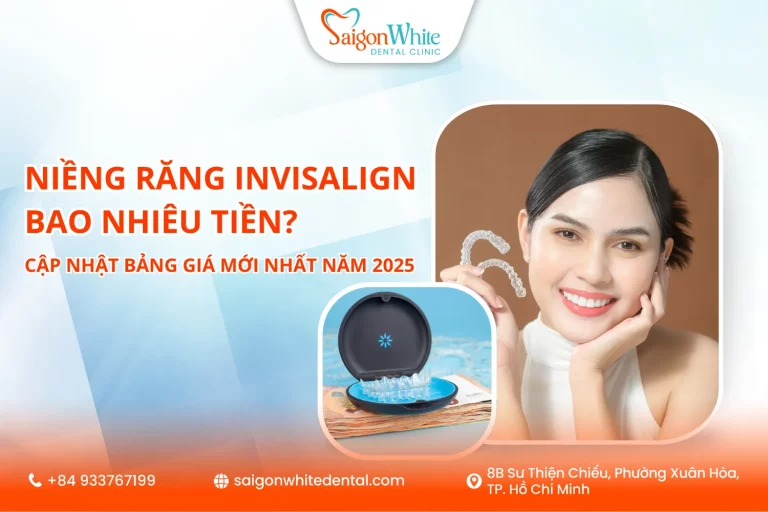 Niềng răng Invisalign bao nhiêu tiền? Cập nhật bảng giá mới nhất năm 2025