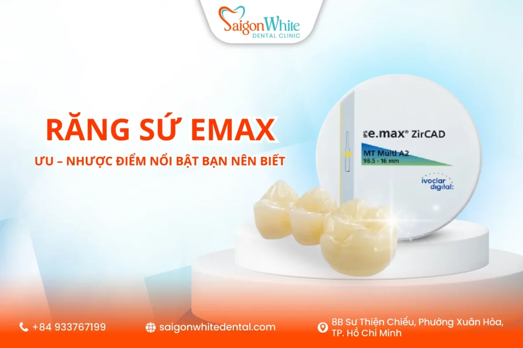 Răng sứ Emax là gì? Ưu – nhược điểm nổi bật