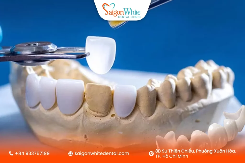 Răng sứ Zirconia là gì?