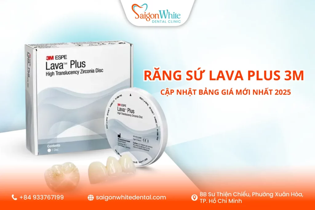Răng sứ Lava Plus 3M là gì? Cập nhật bảng giá mới nhất 2025
