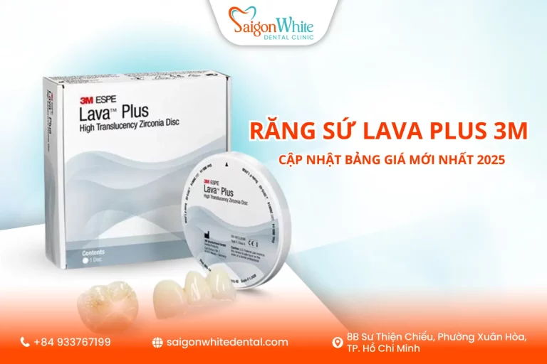 Răng sứ Lava Plus 3M là gì? Cập nhật bảng giá mới nhất 2025